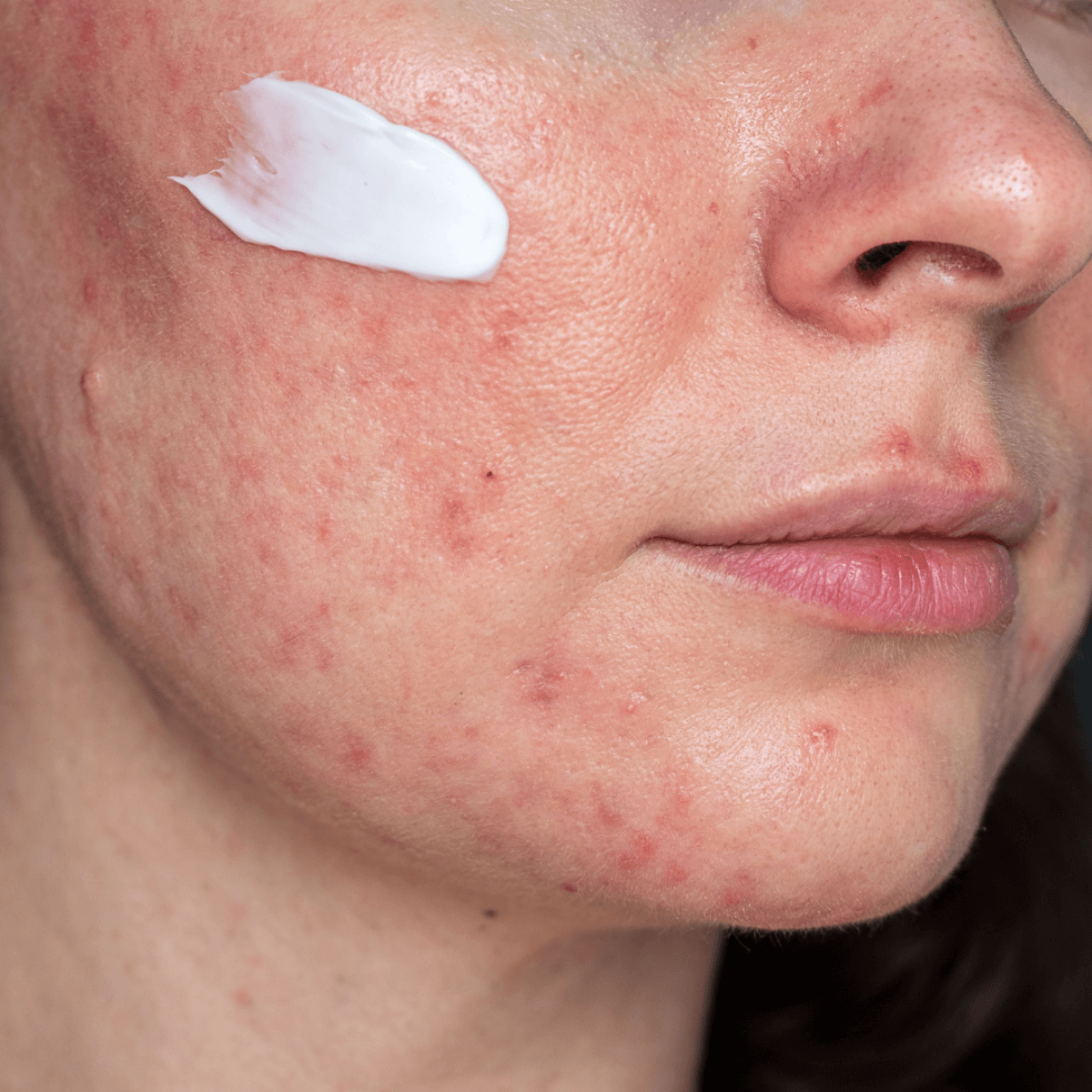 Wagyu Tallow CarriRx