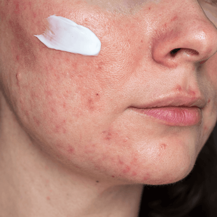 Wagyu Tallow CarriRx